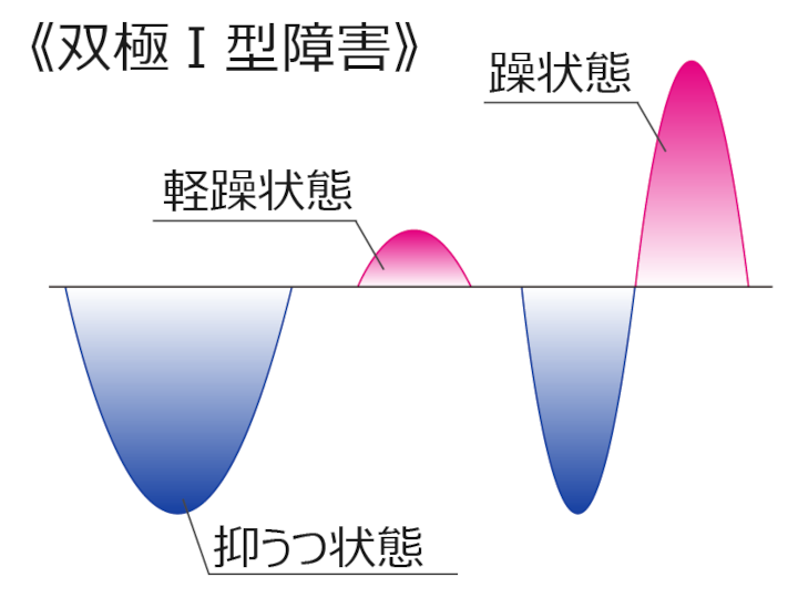 双極Ⅰ型障害の経過図