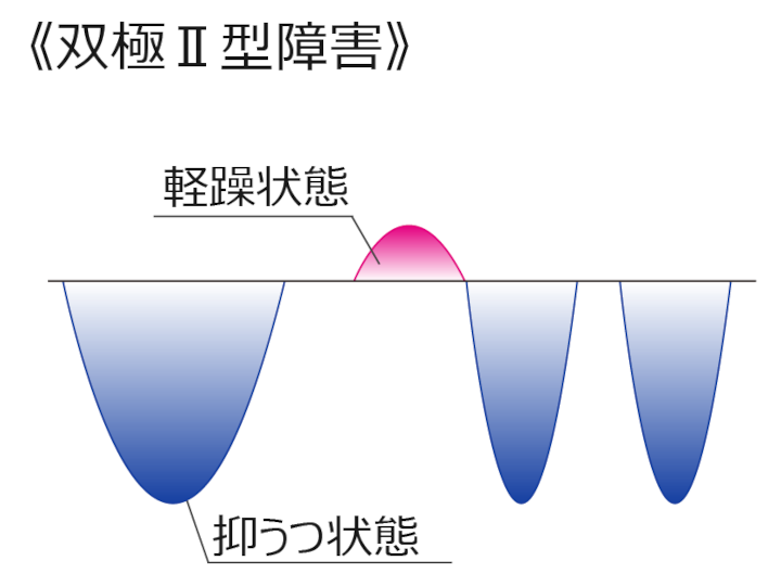 双極Ⅱ型障害の経過図