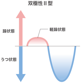 双極性障害Ⅱ型