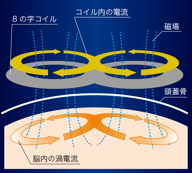 図：8の字コイルへの瞬間的な通電で発生した磁場が、頭蓋骨を貫通して脳内に渦電流を生じさせます。