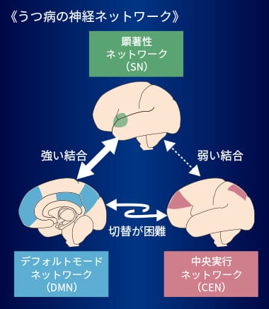 「TMSによるうつ病治療のメカニズム」へ