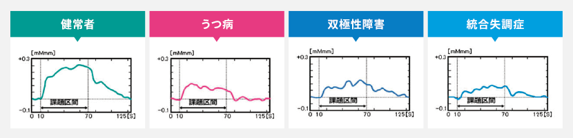 光トポグラフィー検査の原理について