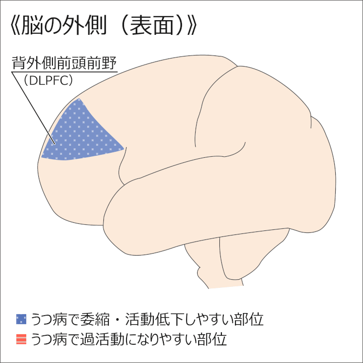 図：脳の外側（表面）／うつ病で萎縮や活動低下しやすい部位（青）：背外側前頭前野（DLPFC）