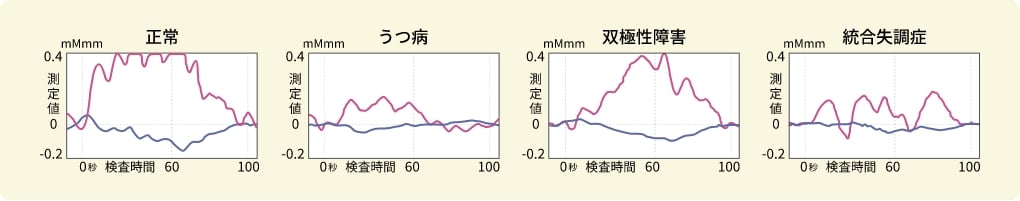光トポグラフィー検査結果が示す症状のパターン
