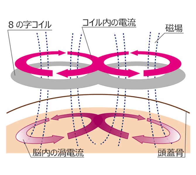 TMS治療が効果を発揮するメカニズム