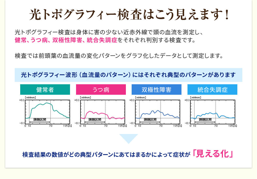 光トポグラフィー検査はこう見えます！