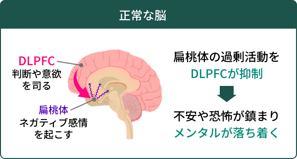 正常な脳