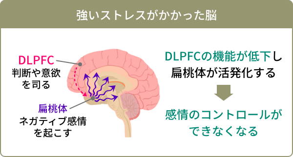 強いストレスがかかった脳