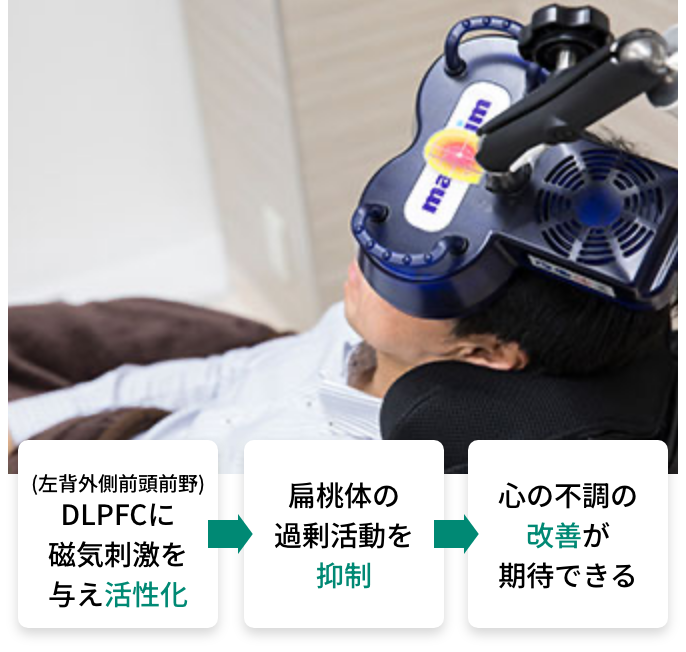 TMS治療している様子